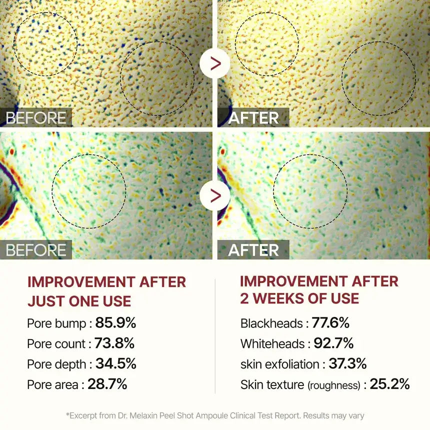 Skin Aura Peel Shot gentle exfoliating serum with pure rice extract for glowing skin, deep hydration, and smooth texture suitable for sensitive skin.