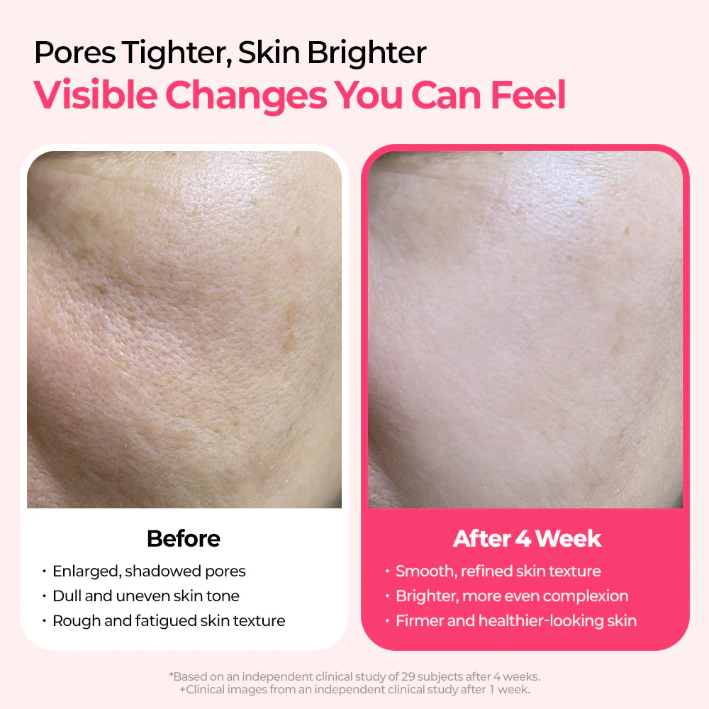 Cemenrete Cyano Pink Spicule Serum