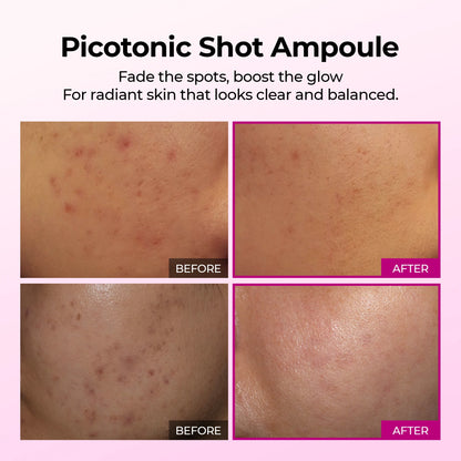 Picotonic Shot Pigmentation Ampoule