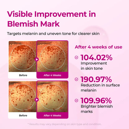 Picotonic Shot Pigmentation Ampoule