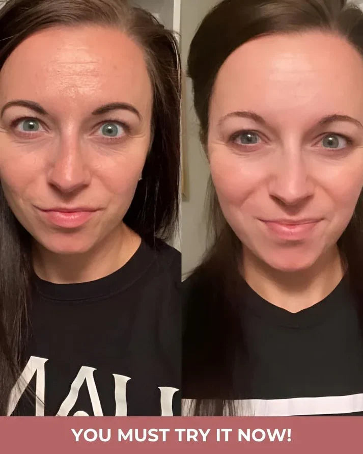Bio-Collagen Masks 2.0