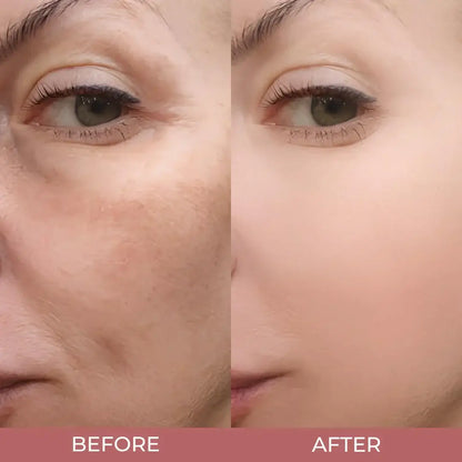 Before and after image showing visible improvement in skin texture, brightness, and smoothness after using Skin Aura Peel Shot exfoliating serum