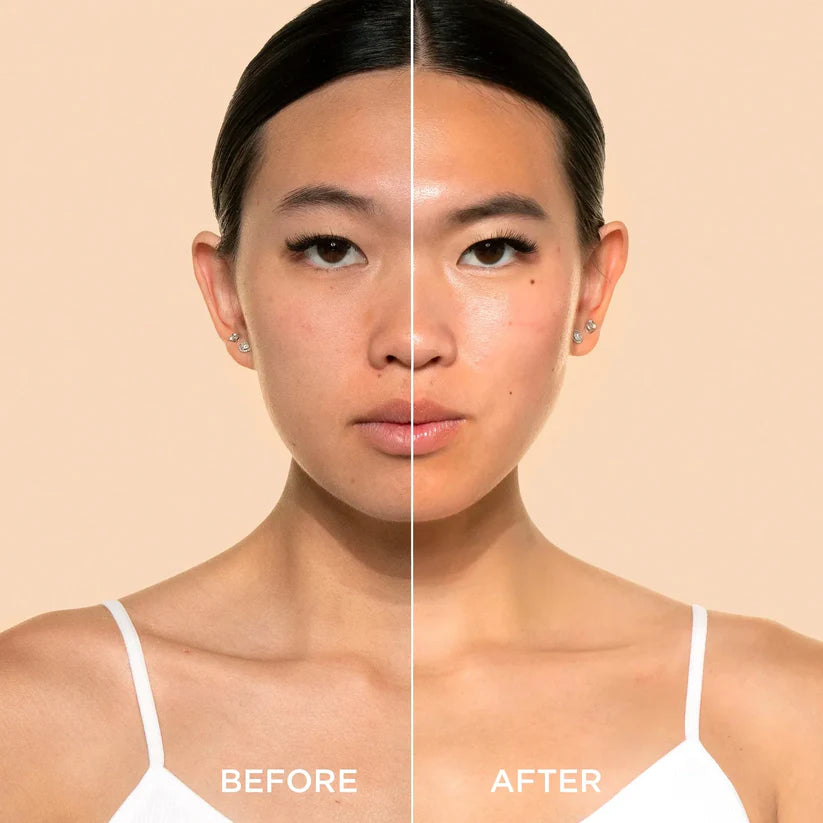 SkinAura™ Peel Shot Glow Rice Ampoule Pair